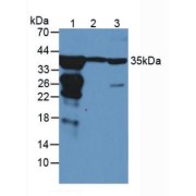 Western blot analysis of (1) Rat Liver Tissue, (2) Rat Blood and (3) Human Liver Tissue.