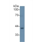 Western blot analysis of Rat Skin lysate, using Human BGN Antibody (1 µg/ml) and HRP-conjugated Goat Anti-Rabbit antibody (<a href="https://www.abbexa.com/index.php?route=product/search&amp;search=abx400043" target="_blank">abx400043</a>, 0.2 µg/ml).