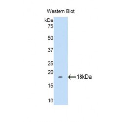 Biglycan (BGN) Antibody