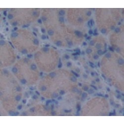 Biglycan (BGN) Antibody