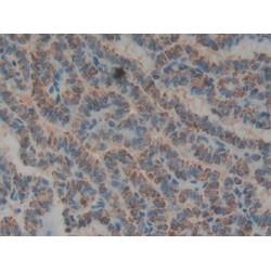 Biglycan (BGN) Antibody