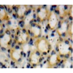 Dymeclin (DYM) Antibody