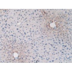 Endoglin / CD105 (ENG) Antibody