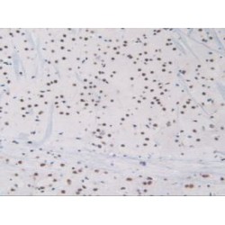 Endoglin / CD105 (ENG) Antibody