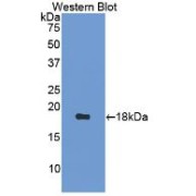 Western blot analysis of the recombinant protein.