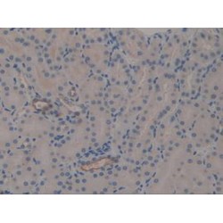 Mucin 1 (MUC1) Antibody