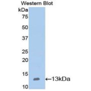 Western blot analysis of the recombinant protein.