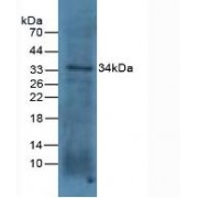 Western blot analysis of Mouse colon Tissue.