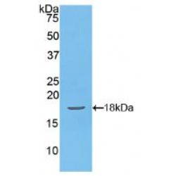 Podocin / PDCN (NPHS2) Antibody