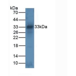 Tryptase (TPS) Antibody