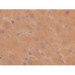 Tryptase (TPS) Antibody