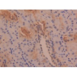 Tryptase (TPS) Antibody