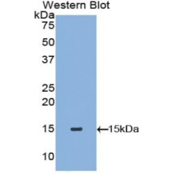 Tryptase (TPS) Antibody