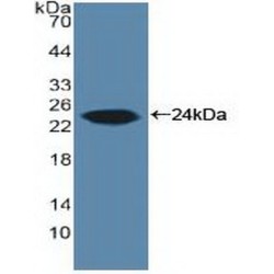 Aromatase (CYP19A1) Antibody