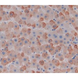 Calcitonin (CALCA) Antibody