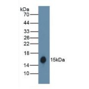 Western blot analysis of the recombinant protein.