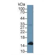 Western blot analysis of Human Liver lysate, using Simian hemoglobin Antibody (1 µg/ml) and HRP-conjugated Goat Anti-Rabbit antibody (<a href="https://www.abbexa.com/index.php?route=product/search&amp;search=abx400043" target="_blank">abx400043</a>, 0.2 µg/ml).