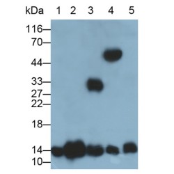 Hemoglobin (HB) Antibody