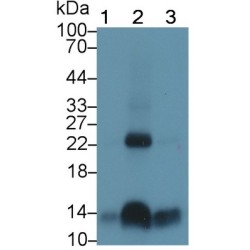 Hemoglobin (HB) Antibody