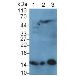 Hemoglobin (HB) Antibody