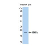 Western blot analysis of the recombinant protein.