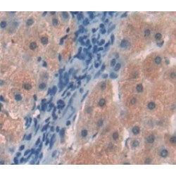 Hemopexin (HPX) Antibody