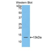 Western blot analysis of recombinant Human Pro-Hepcidin (Pro-HAMP).