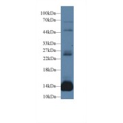 Western blot analysis of Mouse Heart lysate, using Rat MYO Antibody (1 µg/ml) and HRP-conjugated Goat Anti-Rabbit antibody (<a href="https://www.abbexa.com/index.php?route=product/search&amp;search=abx400043" target="_blank">abx400043</a>, 0.2 µg/ml).