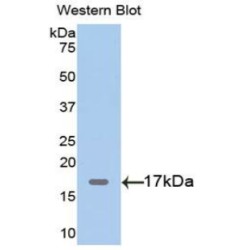 Myoglobin (MB) Antibody