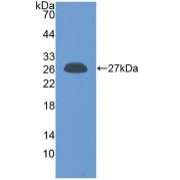 Western blot analysis of recombinant Human PRL.