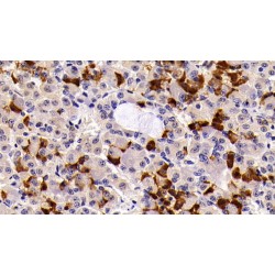 Prolactin (PRL) Antibody