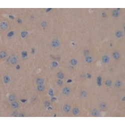 Prolactin (PRL) Antibody