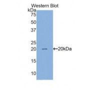 Western blot analysis of recombinant Human Surv.