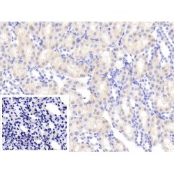 Angiogenin (ANG) Antibody