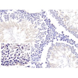 Angiogenin (ANG) Antibody