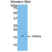 Western blot analysis of the recombinant protein.