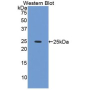 Western blot analysis of the recombinant protein.