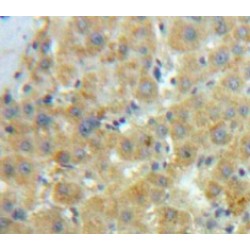 Caldesmon (CALD1) Antibody