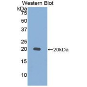 Western blot analysis of the recombinant protein.