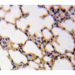 Calmodulin 1 (CALM1) Antibody