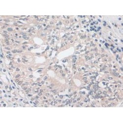 Cytovillin (CVL) Antibody