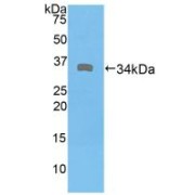 Western blot analysis of recombinant Human DMD.