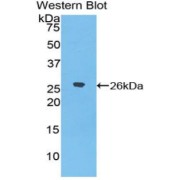 Western blot analysis of recombinant Human EPYC Protein.