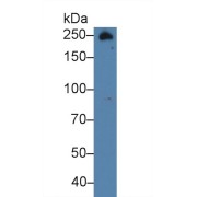 Western blot analysis of Human Urine, using Rabbit Anti-Human FN Antibody (3 µg/ml) and HRP-conjugated Goat Anti-Rabbit antibody (<a href="https://www.abbexa.com/index.php?route=product/search&amp;search=abx400043" target="_blank">abx400043</a>, 0.2 µg/ml).