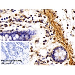 Fibronectin (FN) Antibody