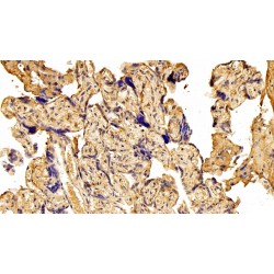 Fibronectin (FN) Antibody