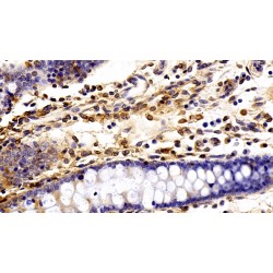 Fibronectin (FN) Antibody