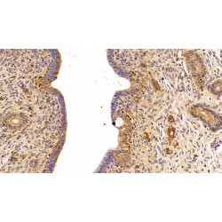 Fibronectin (FN) Antibody