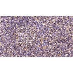 Fibronectin (FN) Antibody