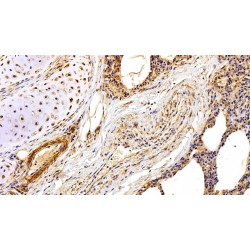 Fibronectin (FN) Antibody